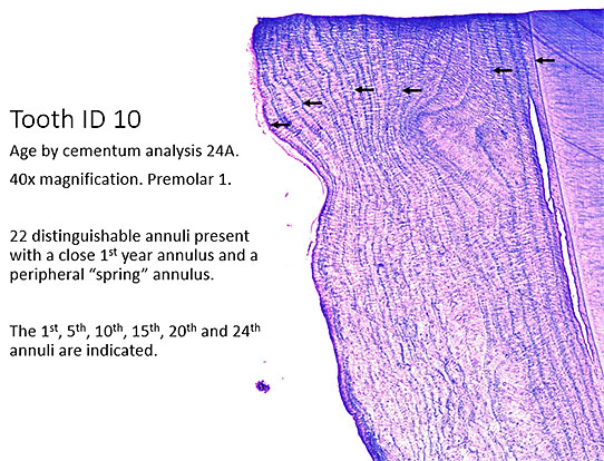 A 24yearold bear In pictures of the magnified toothrootlongitudinal section the slice is made vertically This contrasts the ldquotree ringrdquo analogy where a horizontal section is taken of the tree trunk and the rings are concentric around the center The crown is cut off so the top of this picture is about at the gumline of the tooth